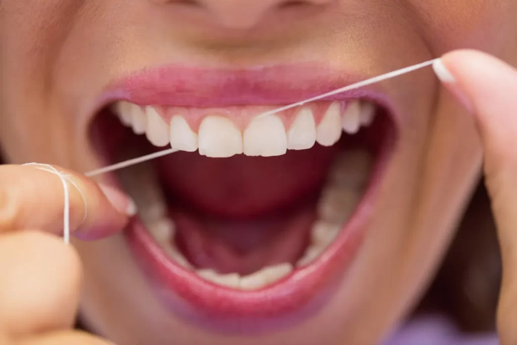 Daily flossing shown as a method for how to avoid root canal and prevent deep tooth decay.