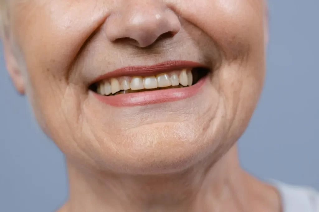 Older adult smiling confidently after dental implants.