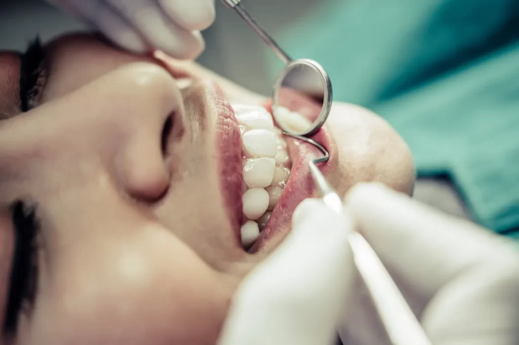 Dental professional examining teeth with a mirror in a calm clinical setting during a routine whitening assessment.