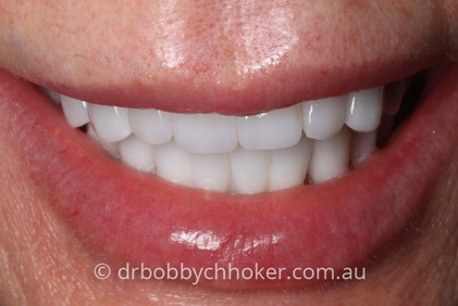 Smile Gallery