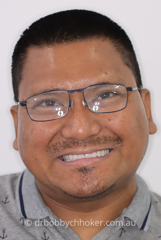 Smile Gallery