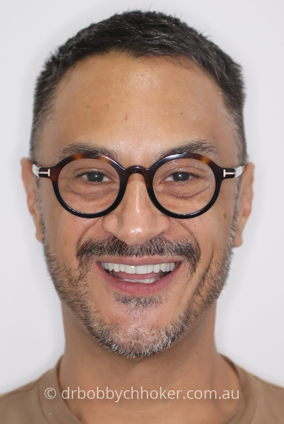 Smile Gallery