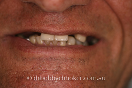 Smile Gallery