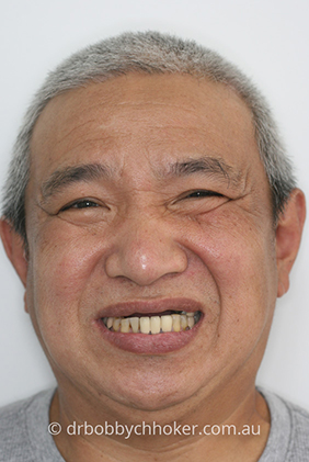Smile Gallery